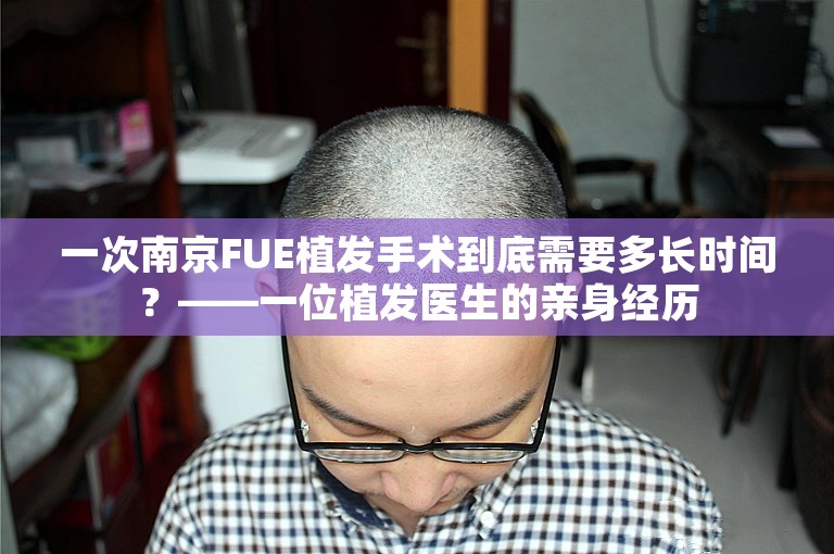 一次南京FUE植发手术到底需要多长时间？——一位植发医生的亲身经历