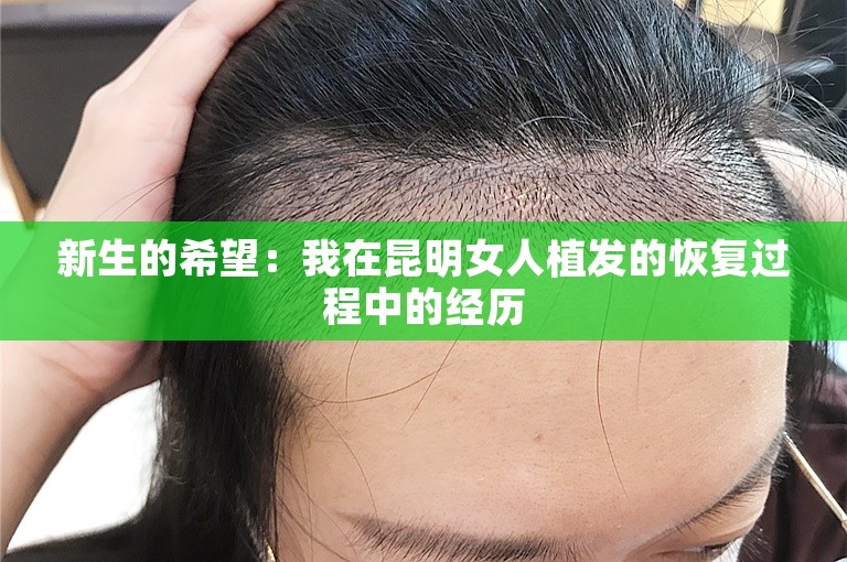 新生的希望：我在昆明女人植发的恢复过程中的经历