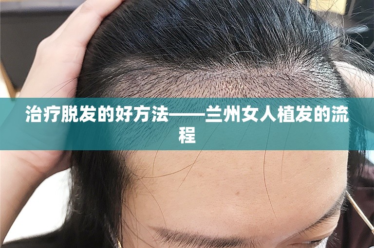 治疗脱发的好方法——兰州女人植发的流程