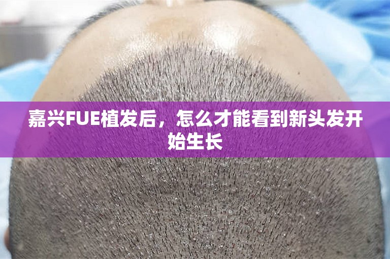 嘉兴FUE植发后，怎么才能看到新头发开始生长