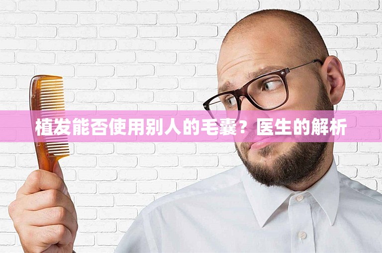 植发能否使用别人的毛囊？医生的解析