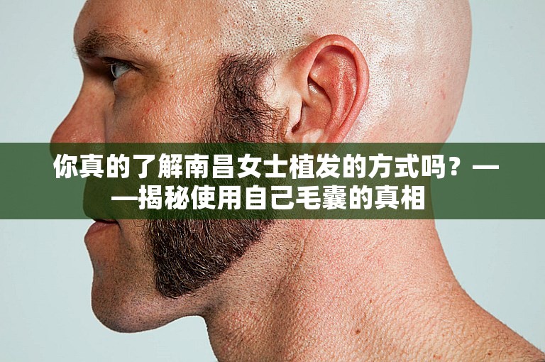  你真的了解南昌女士植发的方式吗？——揭秘使用自己毛囊的真相 