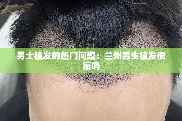 男士植发的热门问题：兰州男生植发很痛吗