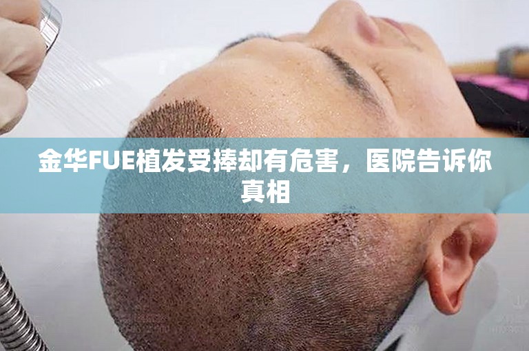 金华FUE植发受捧却有危害，医院告诉你真相