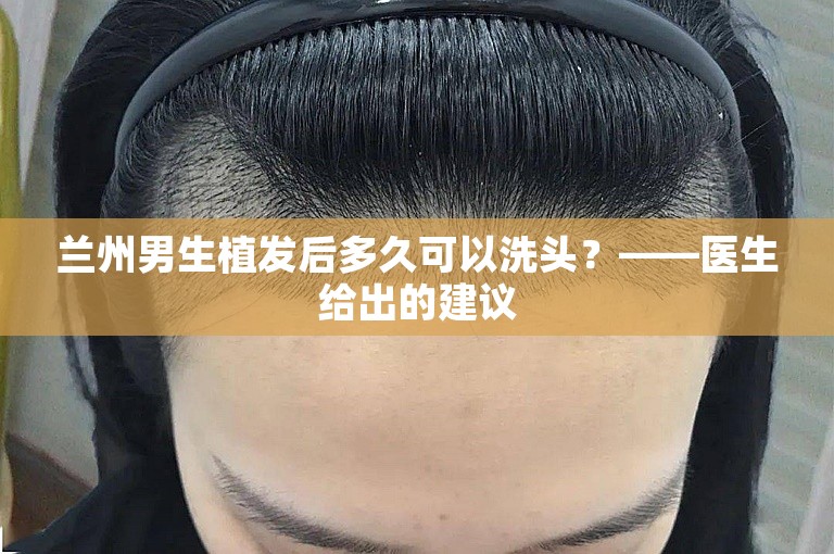 兰州男生植发后多久可以洗头？——医生给出的建议