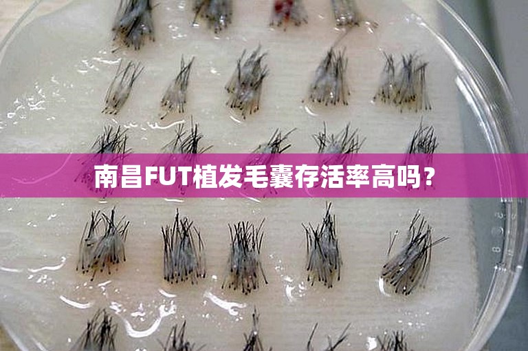 南昌FUT植发毛囊存活率高吗？