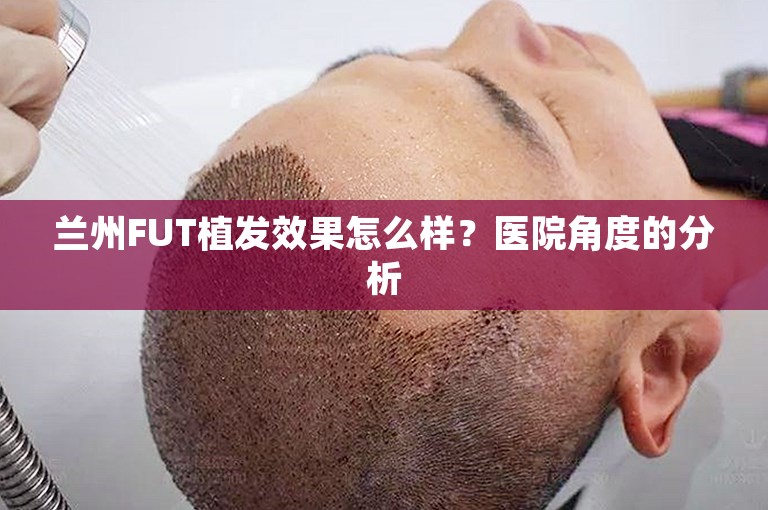 兰州FUT植发效果怎么样？医院角度的分析