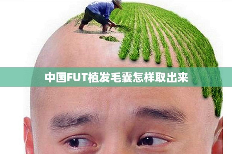 中国FUT植发毛囊怎样取出来