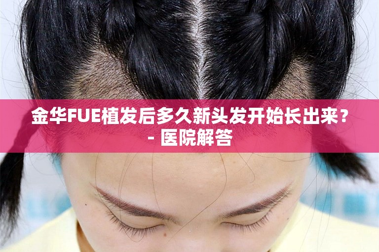 金华FUE植发后多久新头发开始长出来？- 医院解答