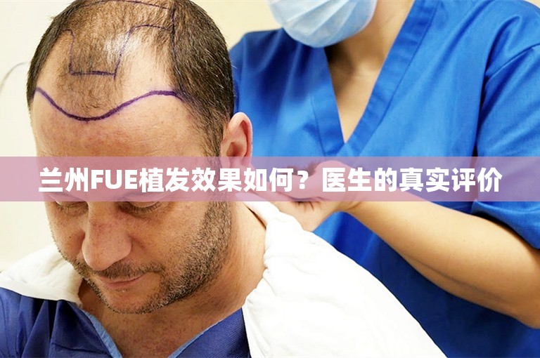 兰州FUE植发效果如何？医生的真实评价