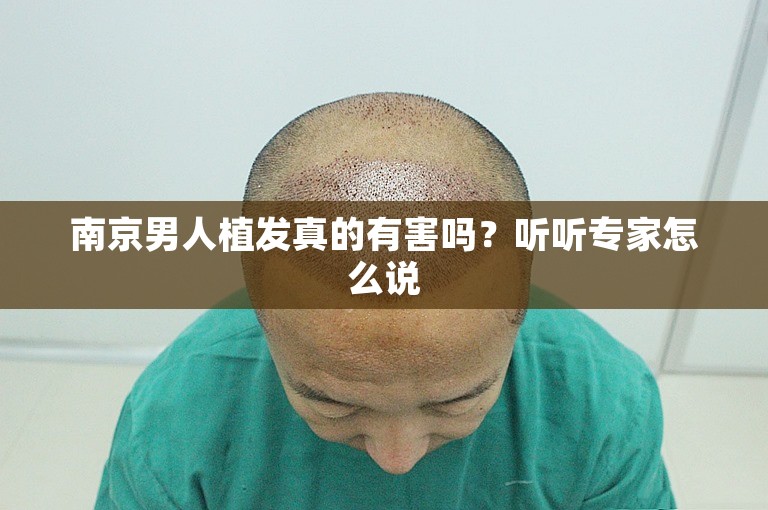 南京男人植发真的有害吗？听听专家怎么说