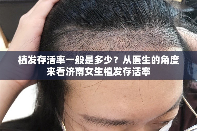 植发存活率一般是多少？从医生的角度来看济南女生植发存活率