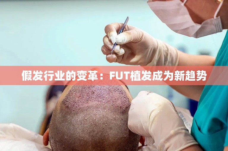 假发行业的变革：FUT植发成为新趋势