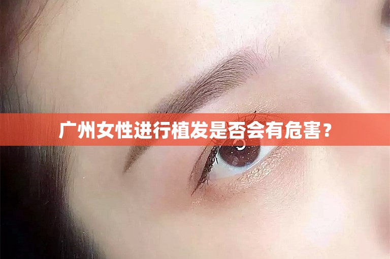 广州女性进行植发是否会有危害？