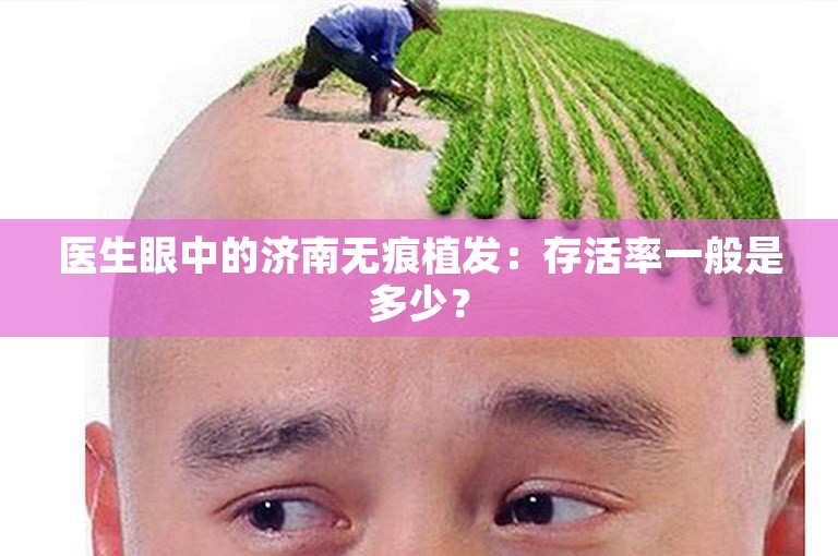 医生眼中的济南无痕植发：存活率一般是多少？