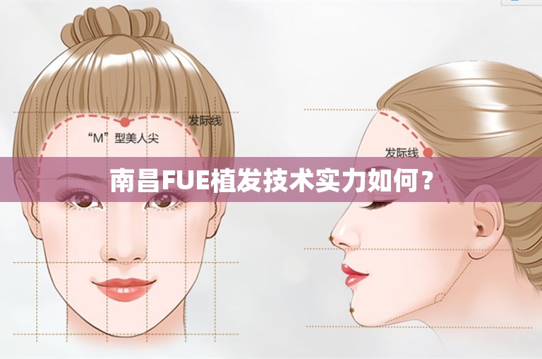 南昌FUE植发技术实力如何？