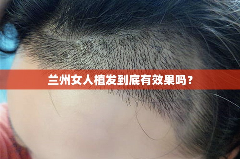 兰州女人植发到底有效果吗？