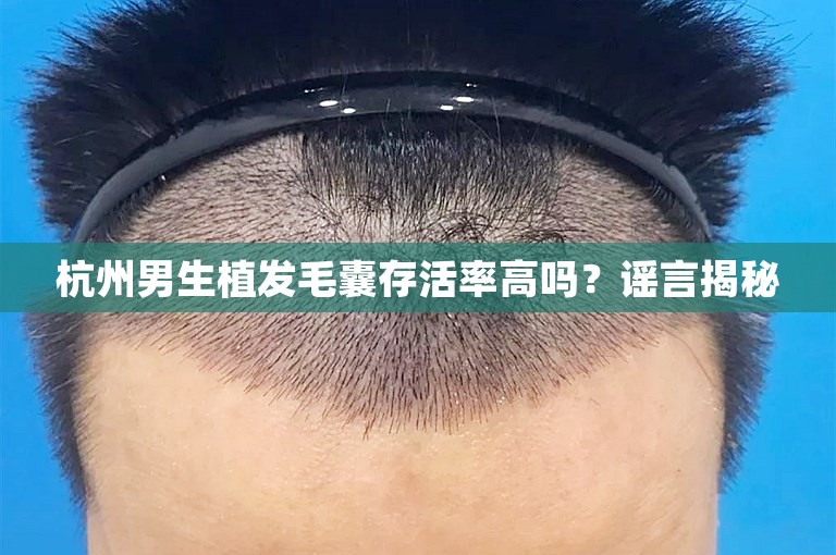 杭州男生植发毛囊存活率高吗？谣言揭秘