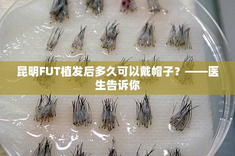 昆明FUT植发后多久可以戴帽子？——医生告诉你