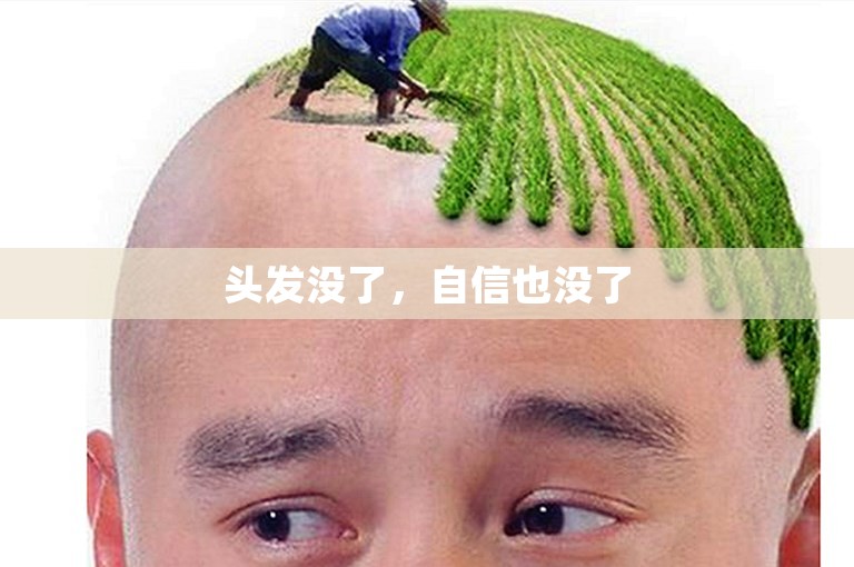 头发没了，自信也没了