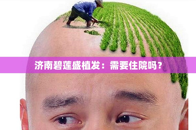 济南碧莲盛植发：需要住院吗？