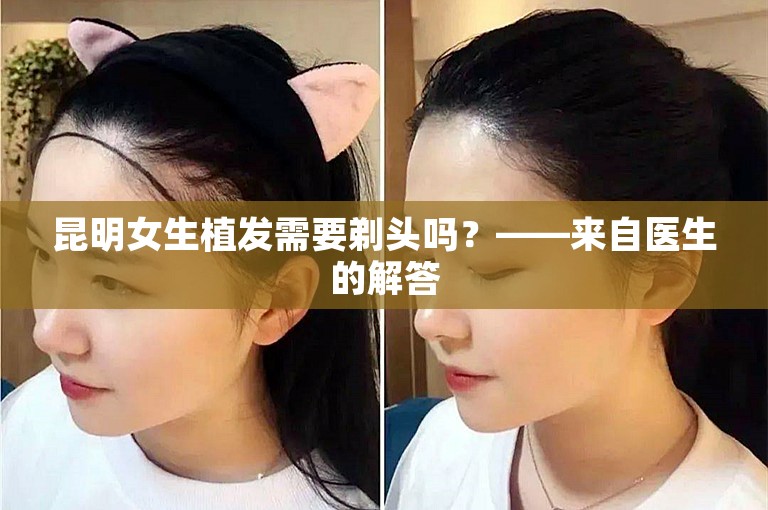 昆明女生植发需要剃头吗？——来自医生的解答