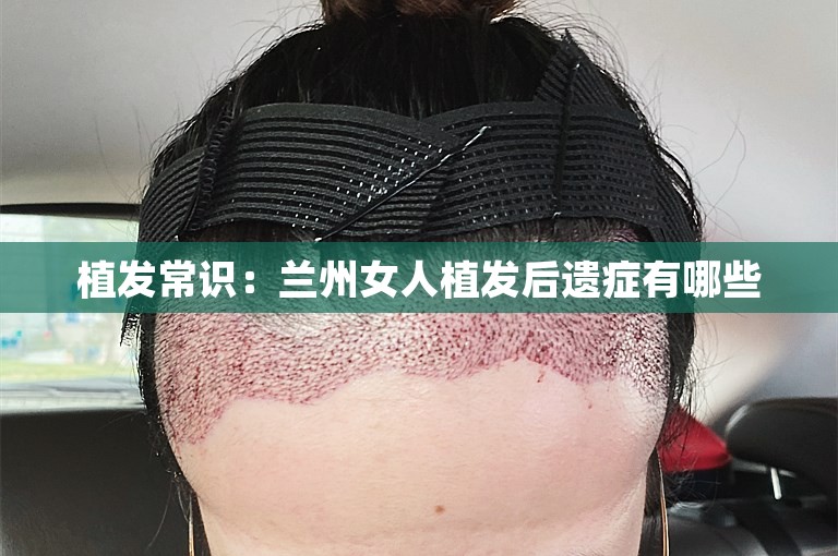 植发常识：兰州女人植发后遗症有哪些