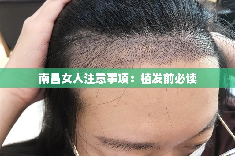 南昌女人注意事项：植发前必读