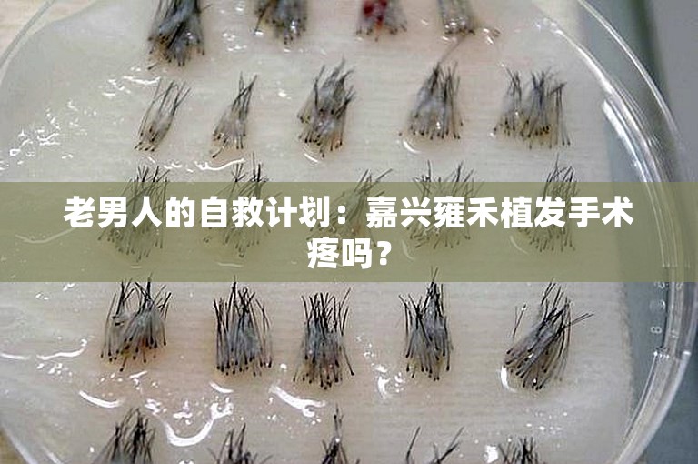 老男人的自救计划：嘉兴雍禾植发手术疼吗？