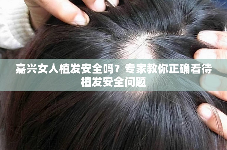 嘉兴女人植发安全吗？专家教你正确看待植发安全问题