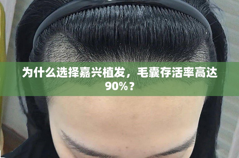 为什么选择嘉兴植发，毛囊存活率高达90%？