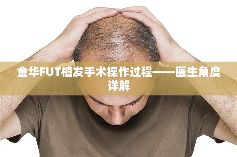 金华FUT植发手术操作过程——医生角度详解