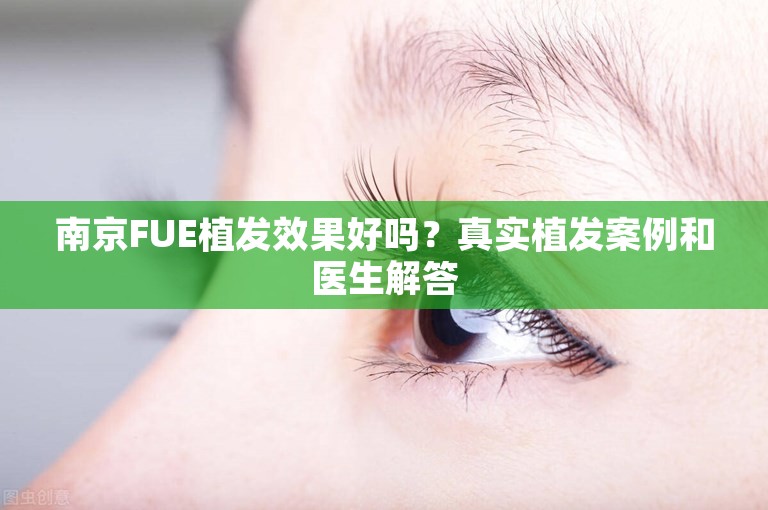 南京FUE植发效果好吗？真实植发案例和医生解答