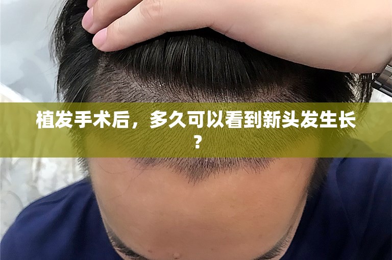 植发手术后，多久可以看到新头发生长？