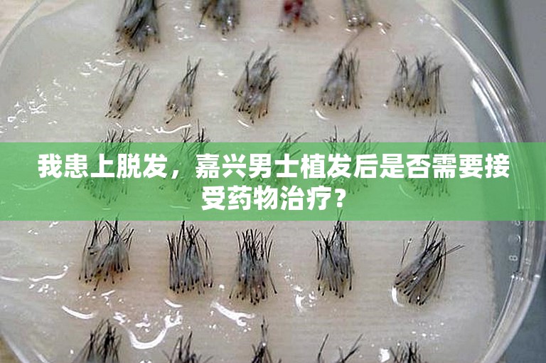 我患上脱发，嘉兴男士植发后是否需要接受药物治疗？