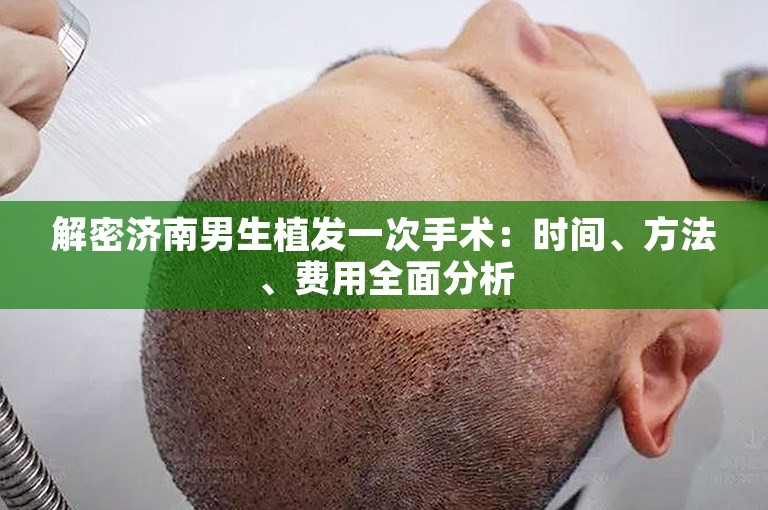 解密济南男生植发一次手术：时间、方法、费用全面分析