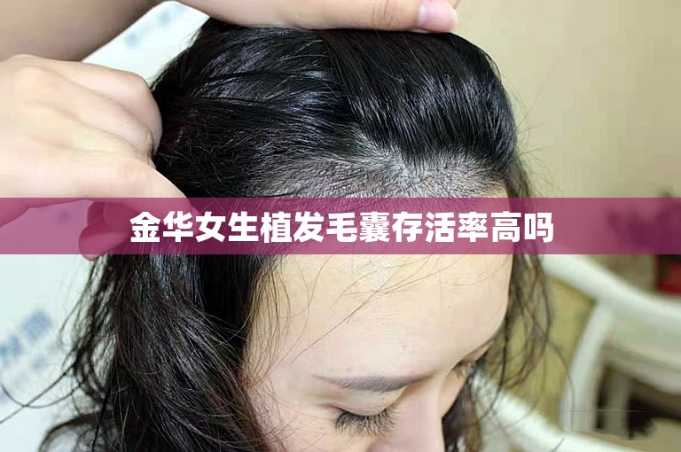 金华女生植发毛囊存活率高吗