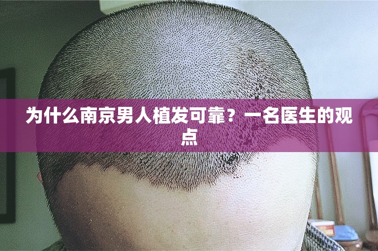 为什么南京男人植发可靠？一名医生的观点