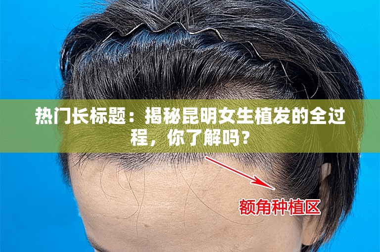 热门长标题：揭秘昆明女生植发的全过程，你了解吗？