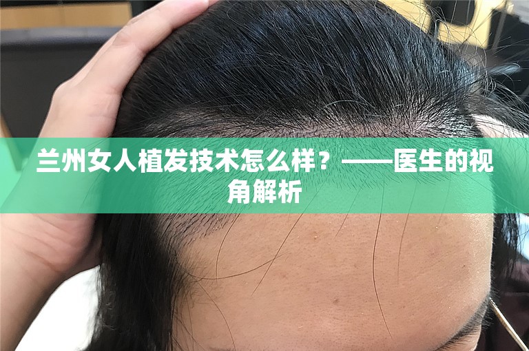 兰州女人植发技术怎么样？——医生的视角解析