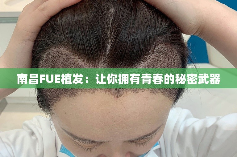 南昌FUE植发：让你拥有青春的秘密武器