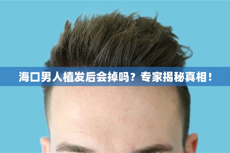 海口男人植发后会掉吗？专家揭秘真相！