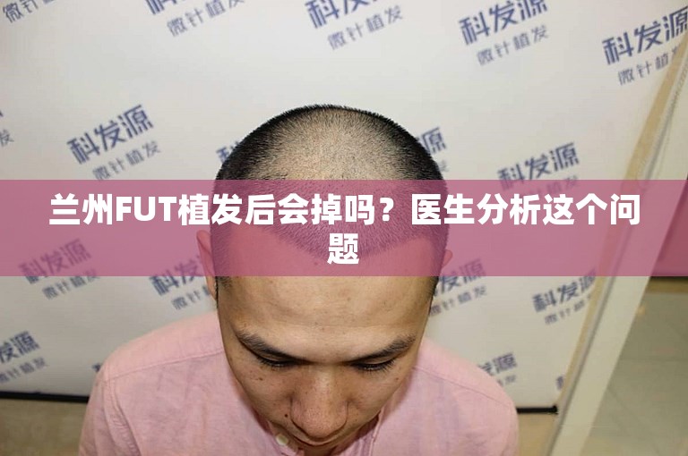 兰州FUT植发后会掉吗？医生分析这个问题