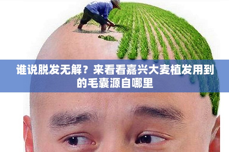 谁说脱发无解？来看看嘉兴大麦植发用到的毛囊源自哪里