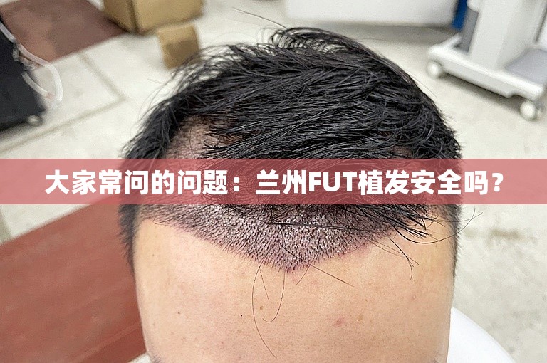 大家常问的问题：兰州FUT植发安全吗？