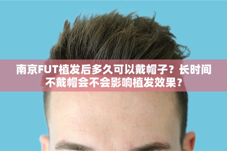 南京FUT植发后多久可以戴帽子？长时间不戴帽会不会影响植发效果？