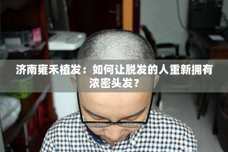 济南雍禾植发：如何让脱发的人重新拥有浓密头发？