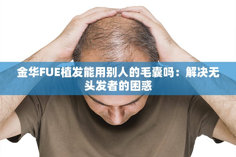 金华FUE植发能用别人的毛囊吗：解决无头发者的困惑