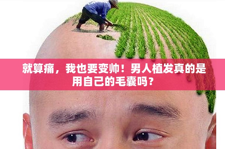  就算痛，我也要变帅！男人植发真的是用自己的毛囊吗？