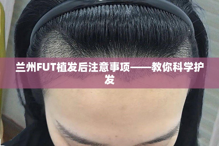 兰州FUT植发后注意事项——教你科学护发